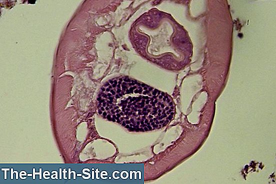 Pinworms diagnózis és kezelés - Paraziták lárva formái