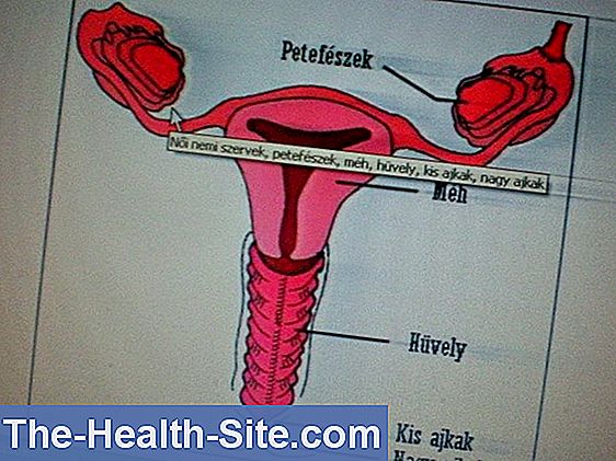 Vírusos szemölcs tünetei és kezelése - HáziPatika, Női nemi szervek papillómái