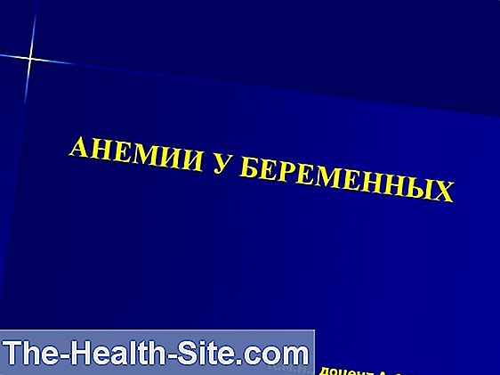 Дефицит Фолиевой Кислоты: Симптомы И Лечение 💊 Научно-практический ...